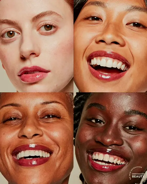 Tila SOS Lip Balm - Fills, Smooths, & Moisturizes