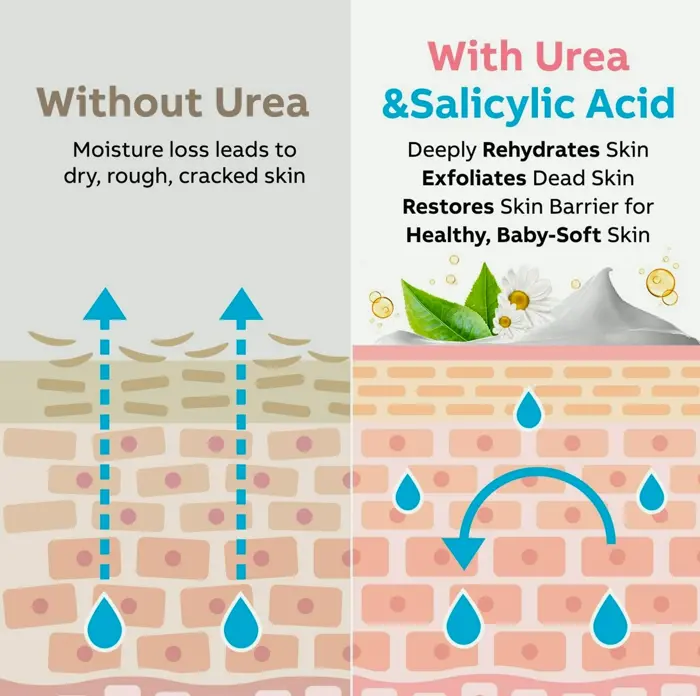 Urea Heel Moisturizer 40% for Cracked Skin, 5.3 OZ