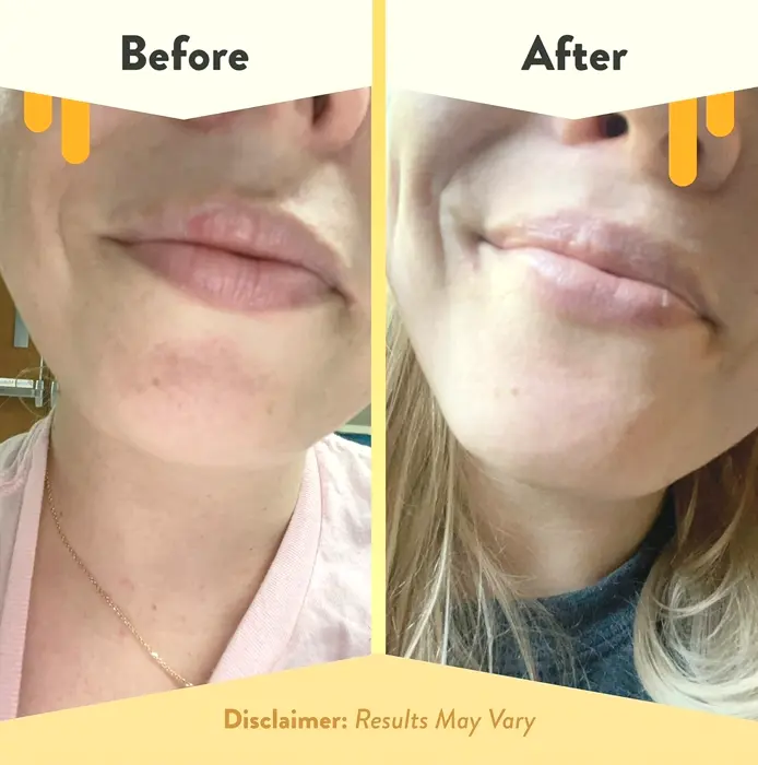 Nurture Lips - Natural Lip Balm for Delicate Lips