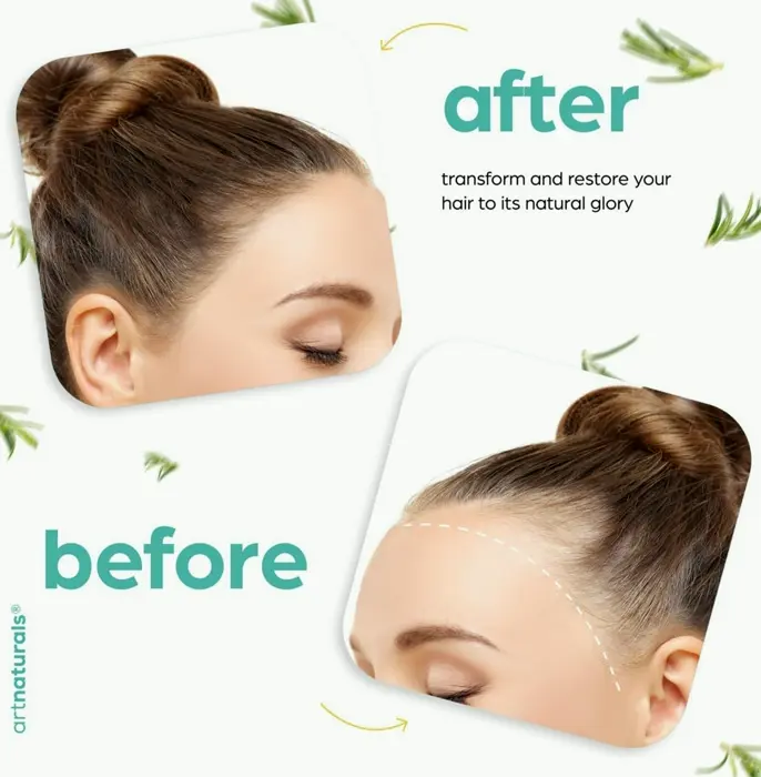 Art Naturals Rosemary-Infused Castor Hair Oil, 4 fl oz