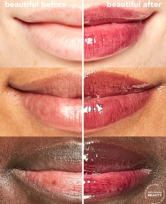 Tila SOS Lip Balm - Fills, Smooths, & Moisturizes