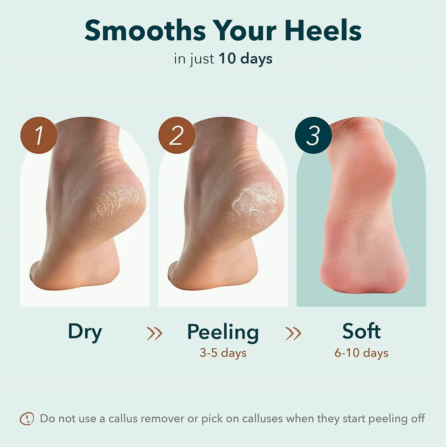 Exfoliating Foot Mask to Callus Care