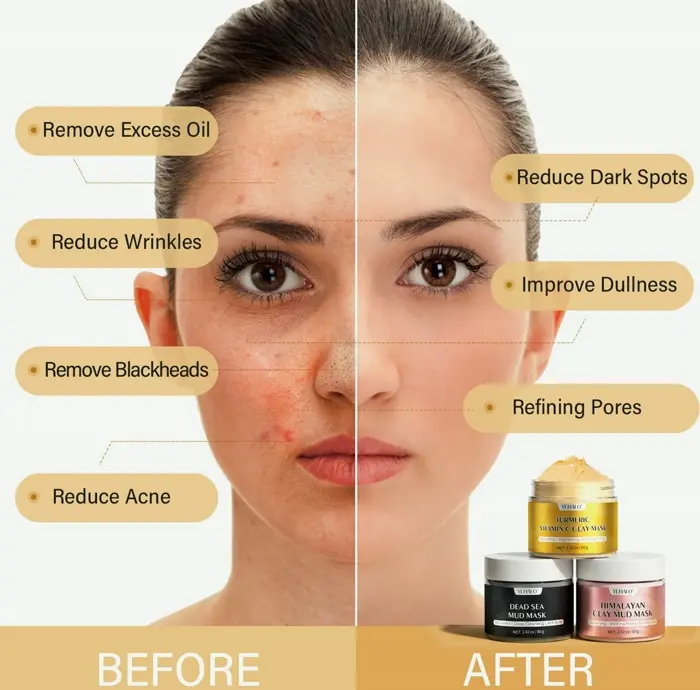 Turmeric Facial Mask Set, Himalayan Mask Set, Skin Cleansing