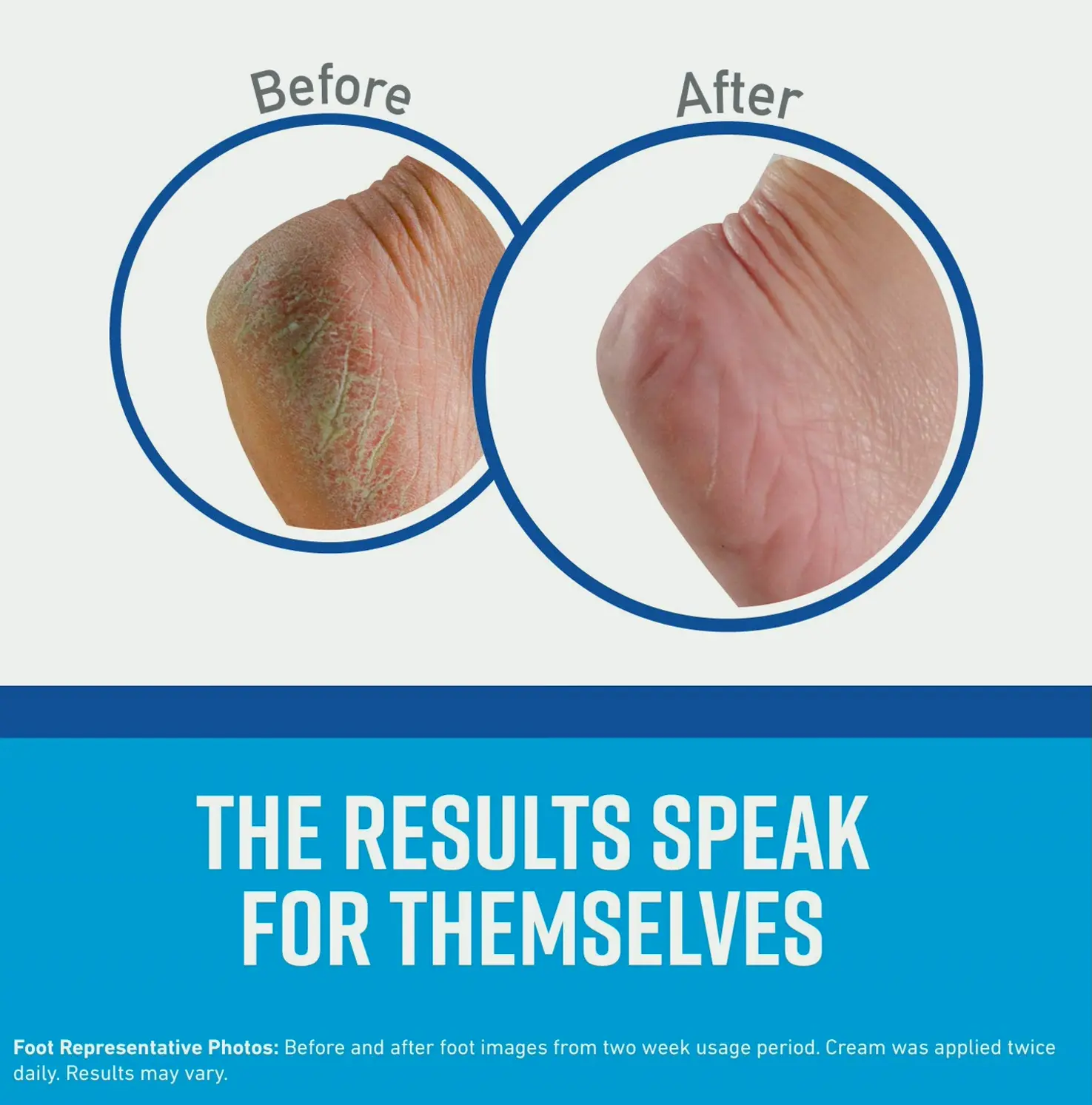 O'Keeffe's Foot Lotion, Treatment for Rough Heels, 7 oz