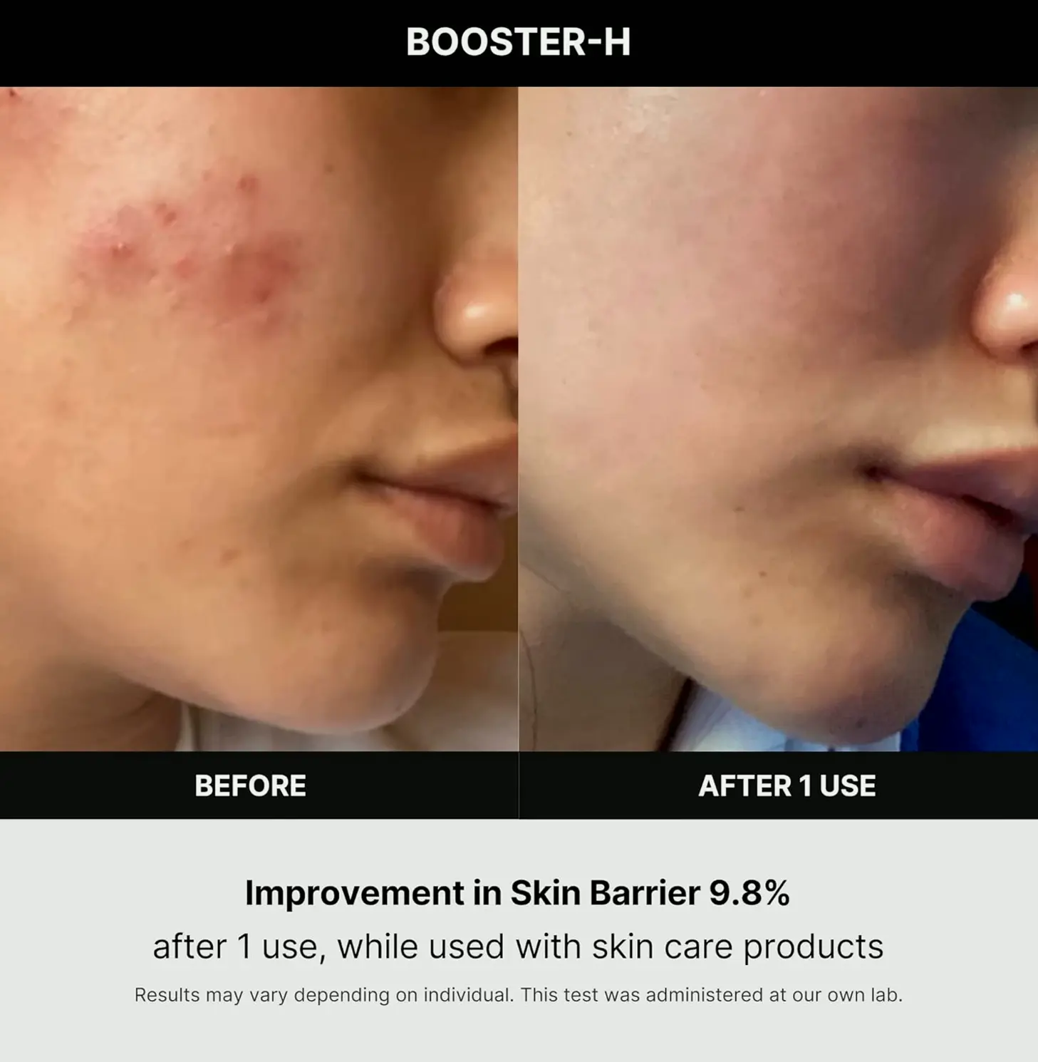 Asian Beauty Device - Medicube Age-R Booster H