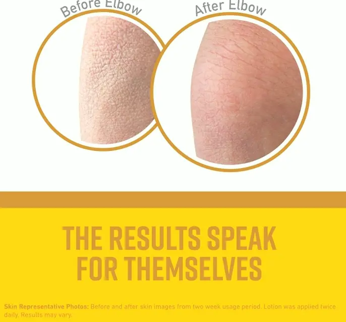 Cold Weather Must-Haves: Hands, Foot, Skin Care