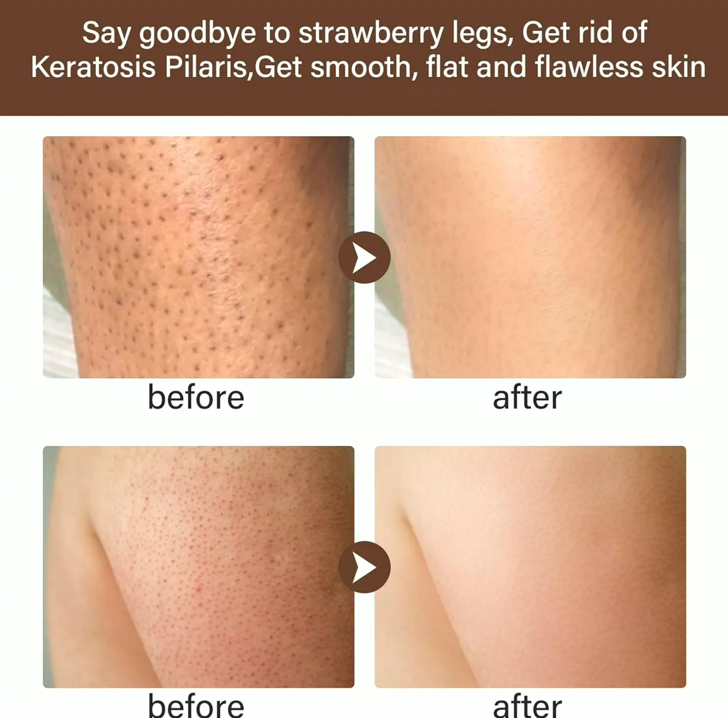 Berry Legs Treatment Lotion for Women