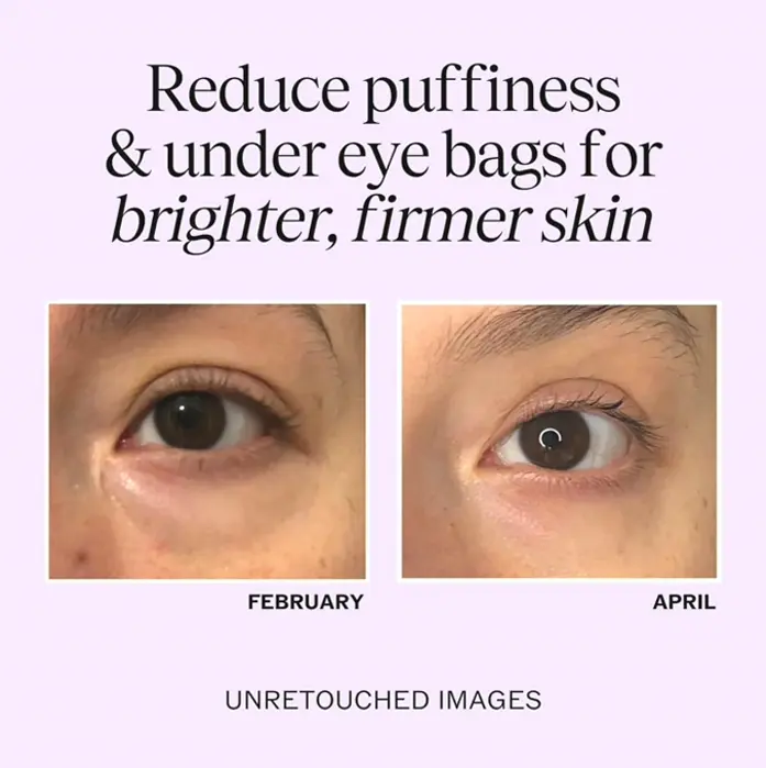 Natural Eye Cream for Under-eye Issues and Puffiness